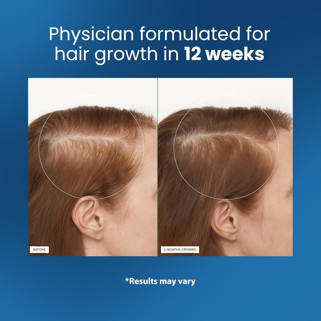 Bodywise Rosemary Hair Growth Serum Roll On 25 ml