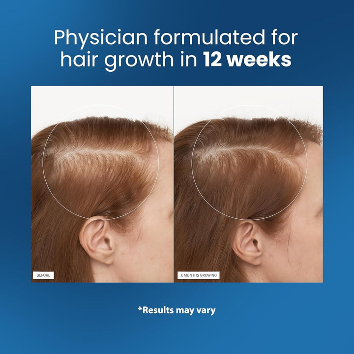 Bodywise Rosemary Hair Growth Serum Roll On 25 ml